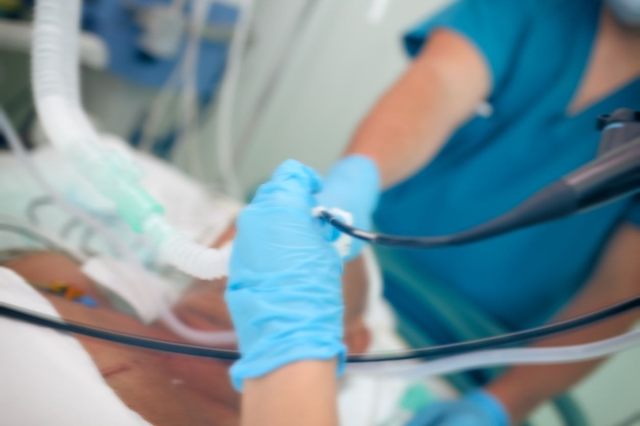 Comment gérer son stress avant une coloscopie