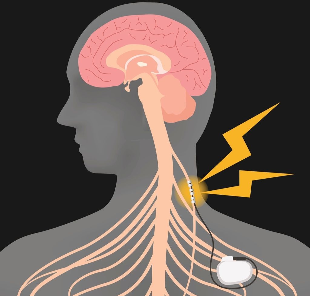 Comment stimuler le nerf vague naturellement pour réduire son stress ?