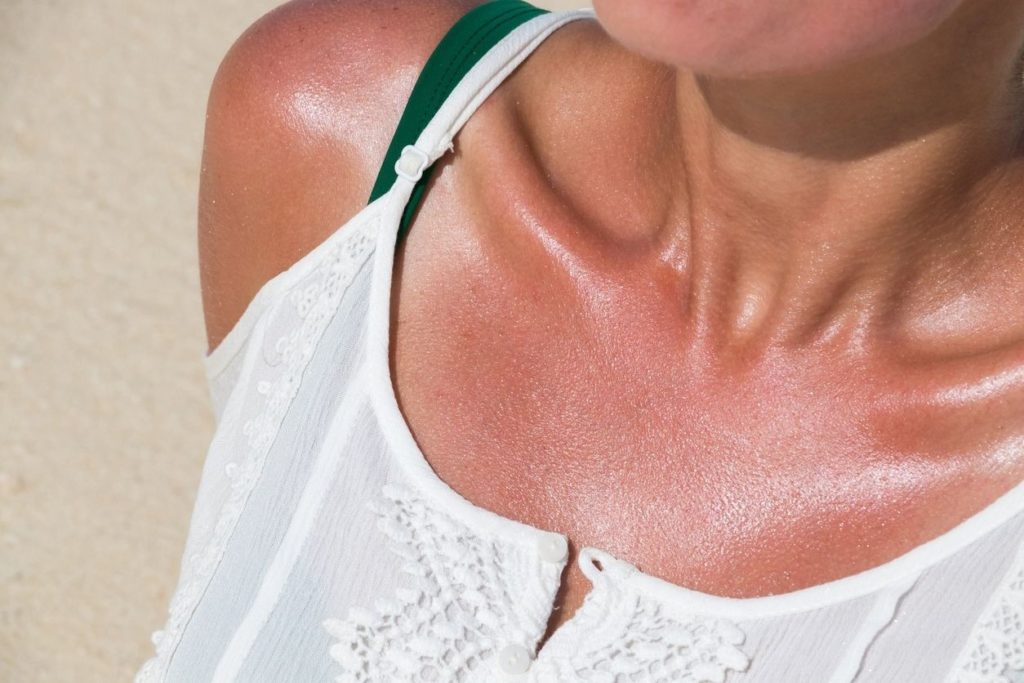 Stress et bronzage : comment protéger sa peau du soleil ?