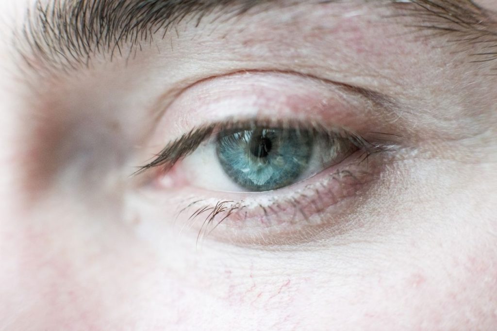 Stress et clignement des yeux : comment calmer ses tics nerveux ?